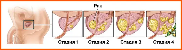 Тревожный символ или график прогрессирования