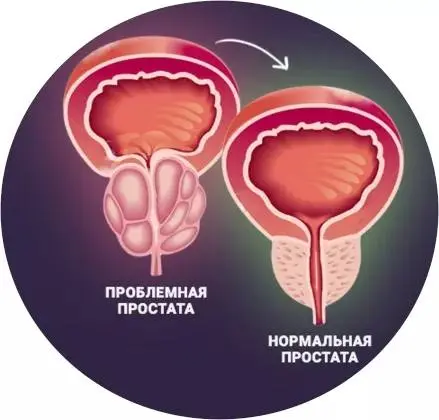 График этапов лечения